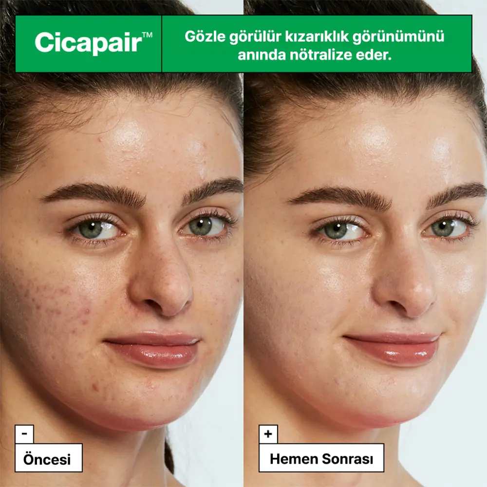 Dr. Jart+ Cicapair Tiger Grass Color Correcting Treatment Cilt Tonu Eşitleyici Krem 50 ml